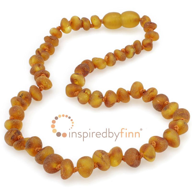 Inspired By Finn Baltic Amber Anklet 11" - New Baby New Paltz